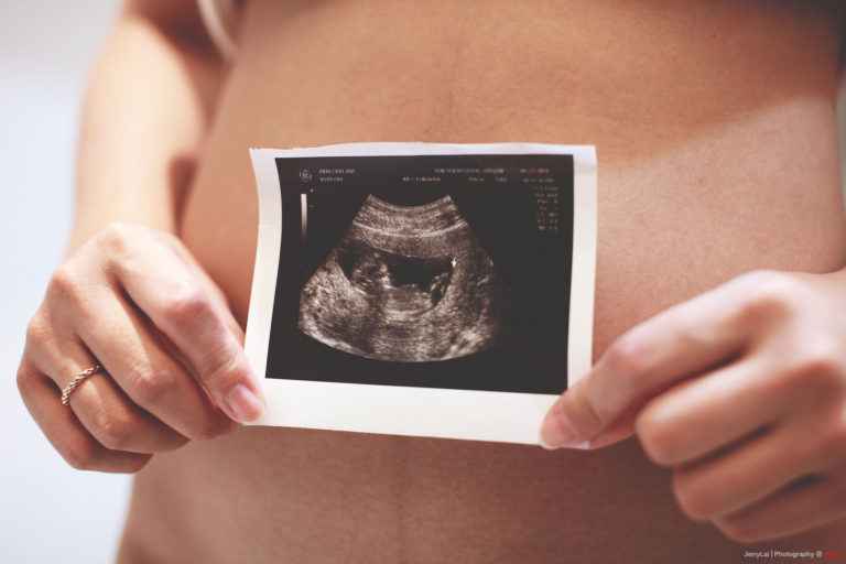 échographie enceinte grossesse