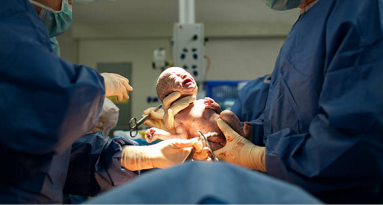 césarienne accouchement bébé hôpital opération médecins