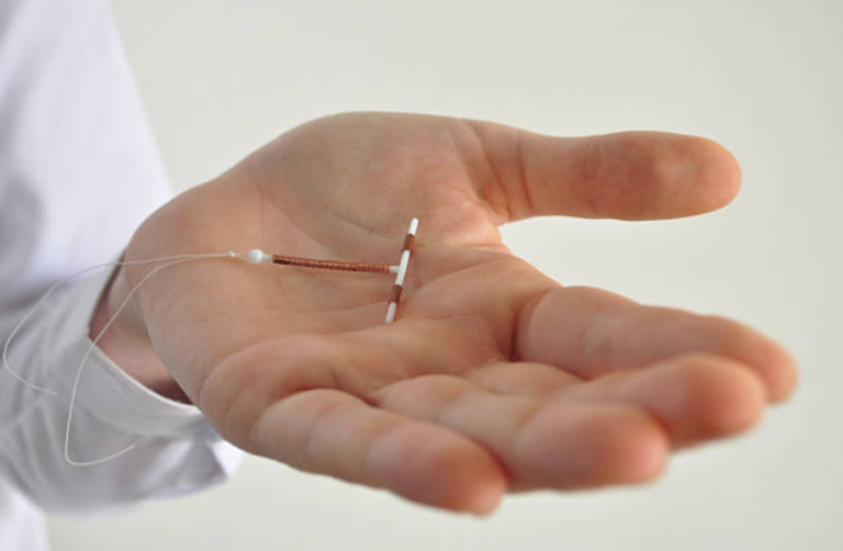 stérilet en cuivre accouchement contraception
