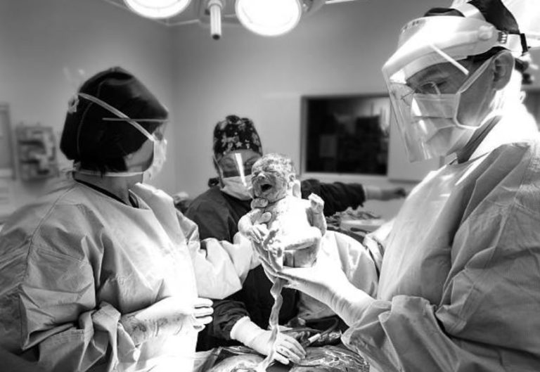 césarienne programmée césarienne de convenance programmée naissance bébé médecin hôpital