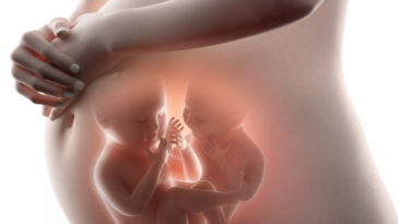 enceinte jumeaux syndrome transfuseur-transfusé