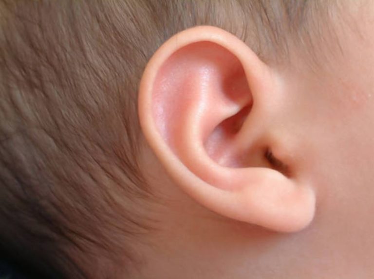 oreille bébé audition surdité sourd