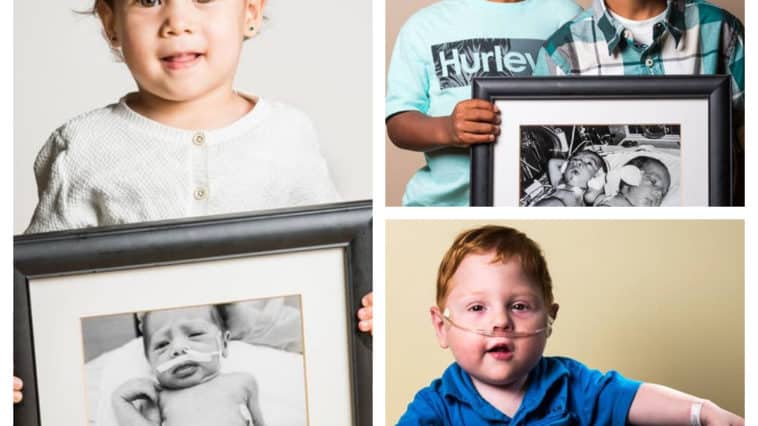 Collage photos évolution bébés prématurés