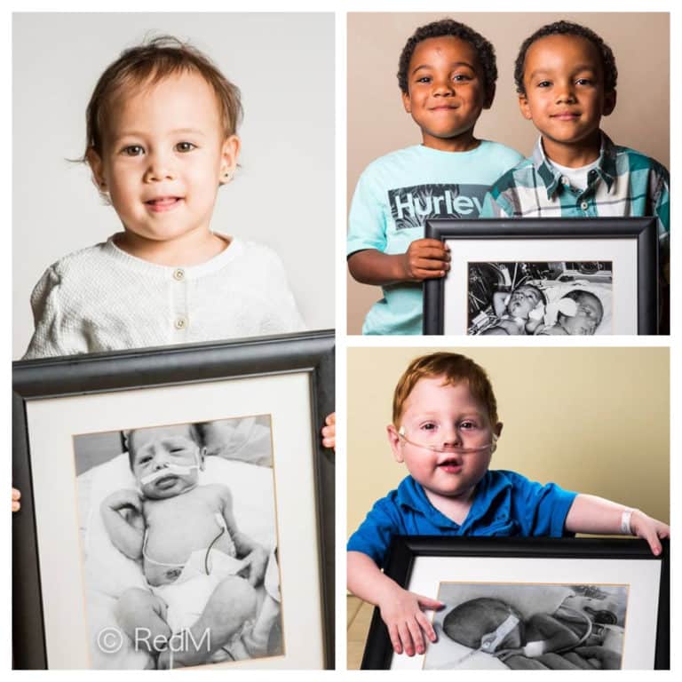 Collage photos évolution bébés prématurés