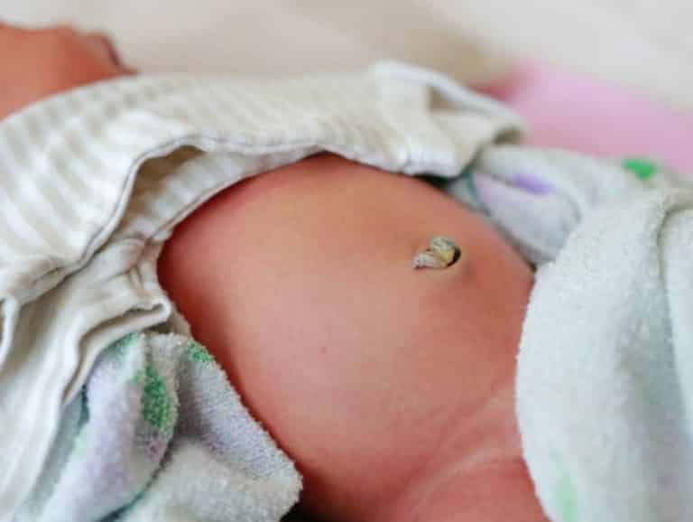 bébé cordon ombilical nombril