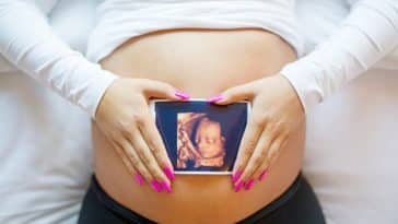 échographie 3D enceinte grossesse ventre