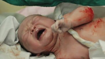 bebe naissance cordon ombilical accouchement cri tour cou