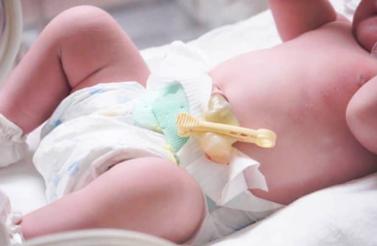 bebe naissance nourrisson cordon ombilical couper nouveau ne